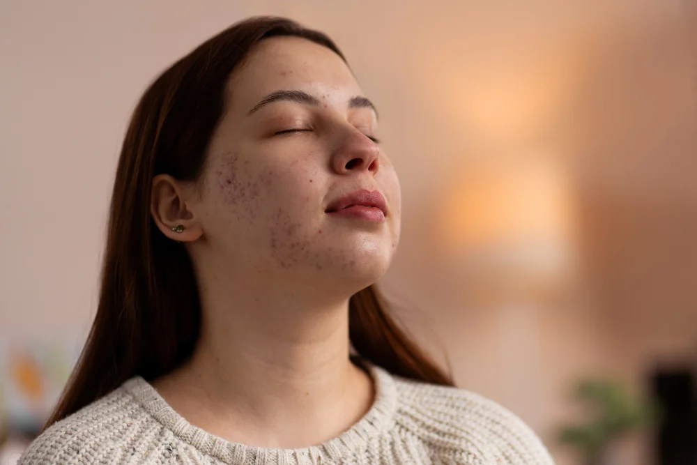 You are currently viewing How Long Does It Take for Salicylic Acid to Work?